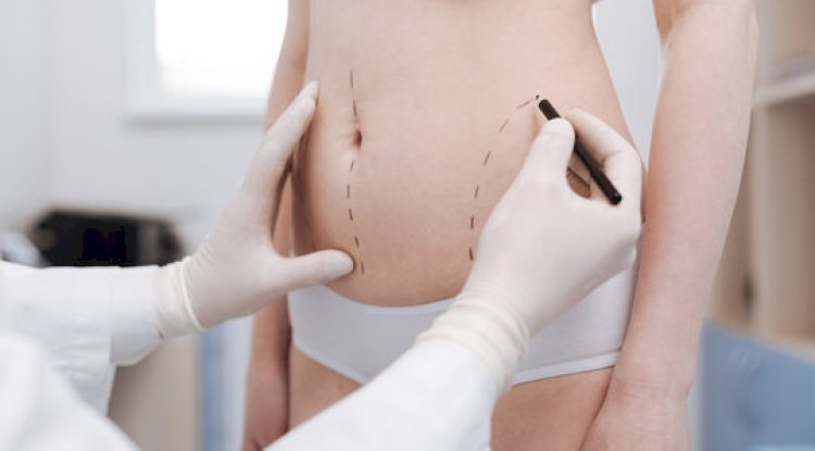 Speeding Up Your Recovery After Liposuction Riyadh