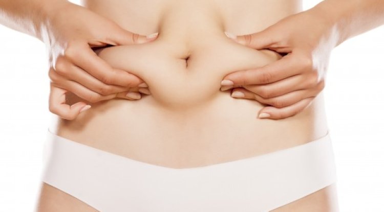 Liposuction in Islamabad: A Solution for Stubborn Body Fat