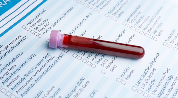 What Makes a Full STD Panel Different From At-Home Tests?