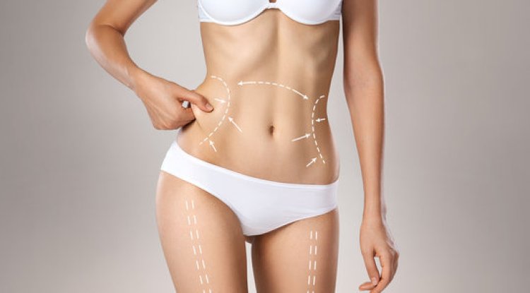Is BodyTite Liposuction Riyadh Painful? What Patients Say