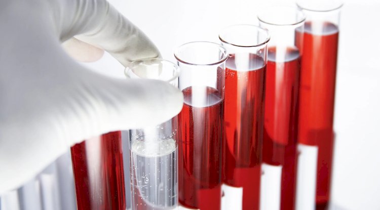Hepatitis C Test and Public Health: Why Widespread Screening Matters