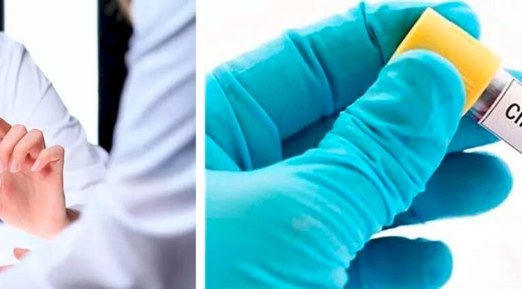 What Doctors Look For in a Chlamydia Test?