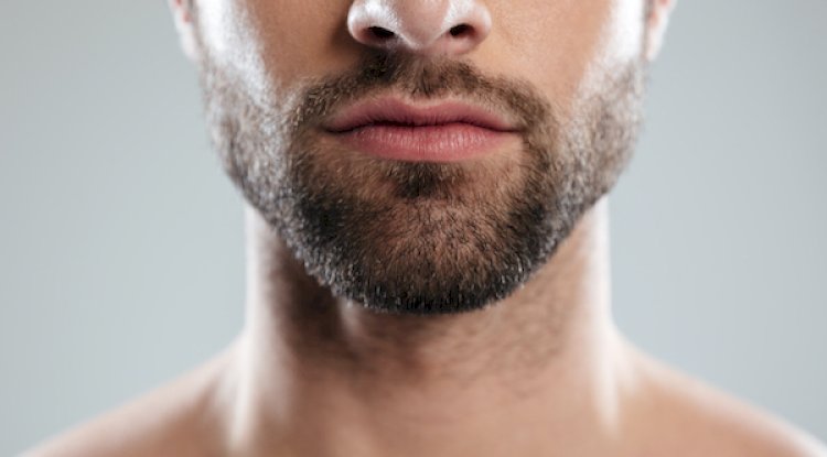 How to Plan Your Beard Hair Transplant in Islamabad Step by Step