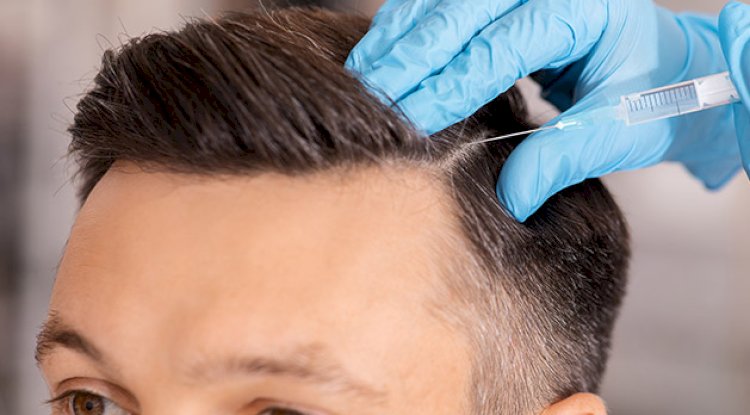 Hidden Costs to Ask About Before Booking a Hair Transplant