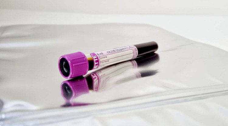 DNA Test Reliability Over Time: Does Science Change the Results?