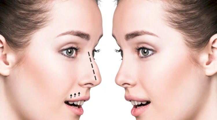 Best Rhinoplasty Surgeons in Dubai: Clinical Judgment Counts