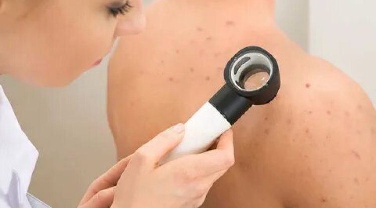 Exploring Preventive Skin Care Strategies at Dermatech Polyclinic