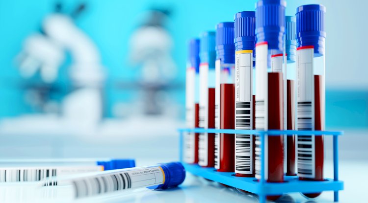 Signs You Shouldn’t Ignore That May Indicate the Need for Syphilis Screening