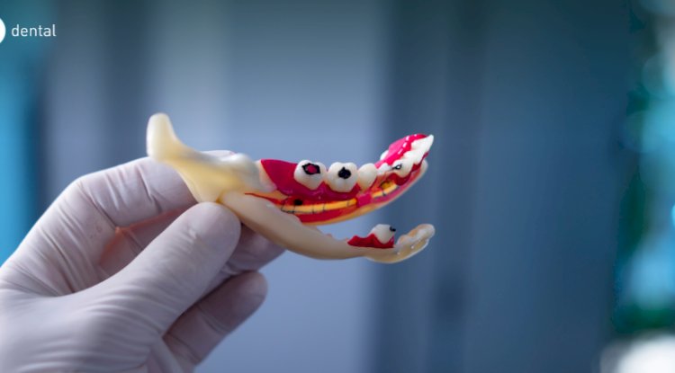 How Lifestyle Habits Affect Your Teeth and Gums