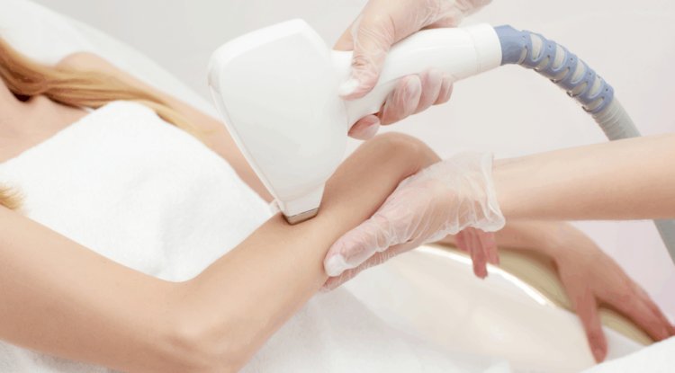 Why More Women in Islamabad Are Choosing Laser Hair Removal