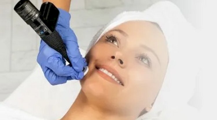 Microchanneling Treatment Benefits for Healthier Skin