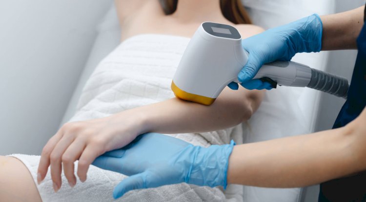 Why Laser Hair Removal Works Better Than Creams?