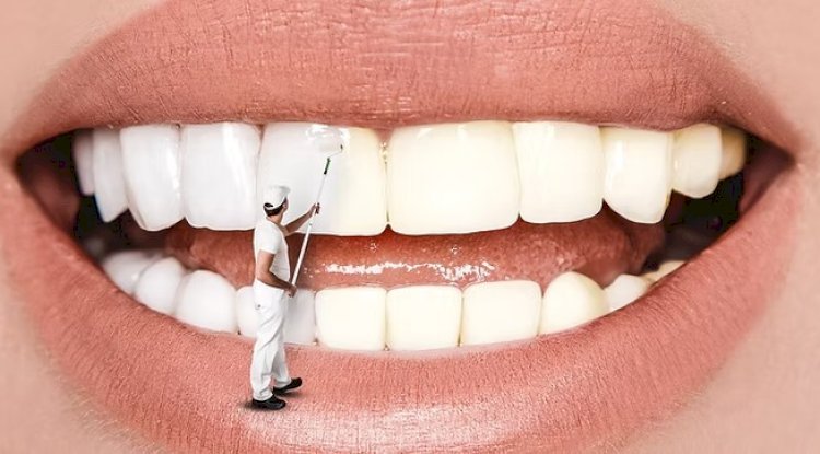 How Can a Dentist in Scarborough Help Protect Your Smile?