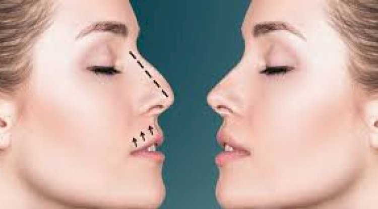 Celebrity-Inspired Rhinoplasty: Natural Looks Without Overdoing It