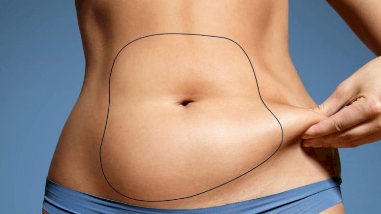 Expert Recovery Guidance from Best Liposuction Surgeons in Dubai
