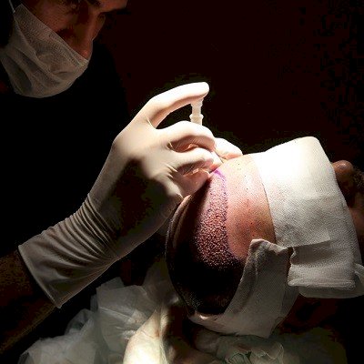 Best Hair Transplant Clinics Near Islamabad’s Medical Centers