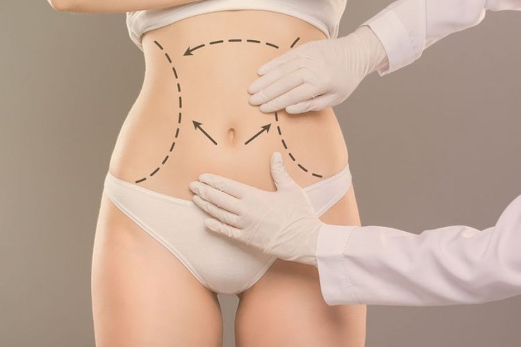 How to Combine Tummy Tuck with Weight Management in Islamabad