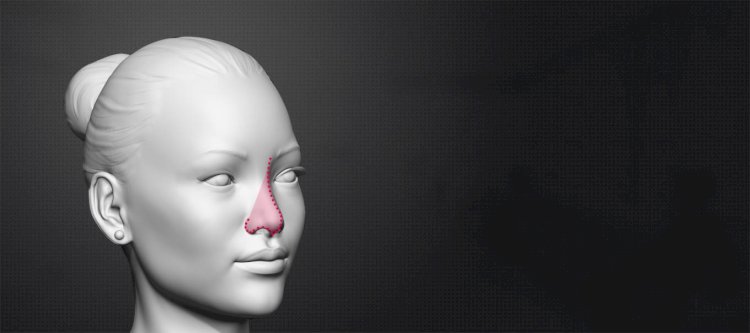 Common Fears About Facial Feminization Surgery