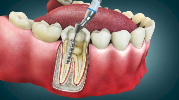 Dentist in Mumbai: Your Guide to Expert Dental Care