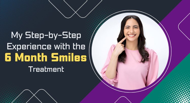 My Step-by-Step Experience with the 6 Month Smiles Treatment