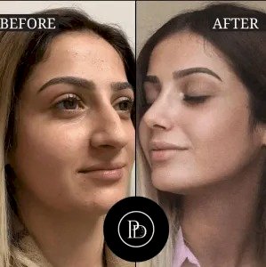 What Happened When I Visited the Best Aesthetic Clinic in Dubai