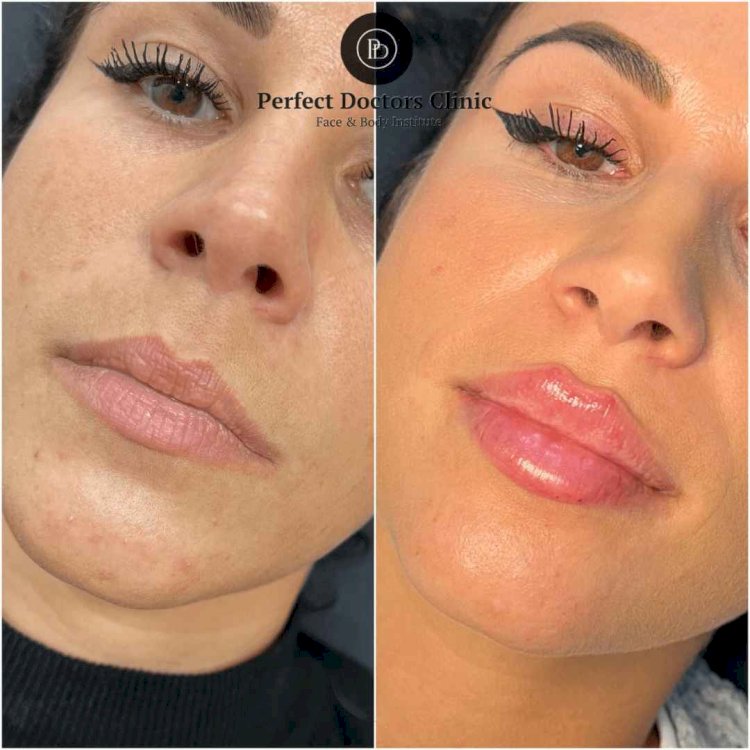 Best Plastic Surgeon in Dubai: Liposuction Techniques You Should Know