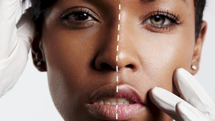 Skin Whitening in Islamabad: Cultural and Religious Considerations