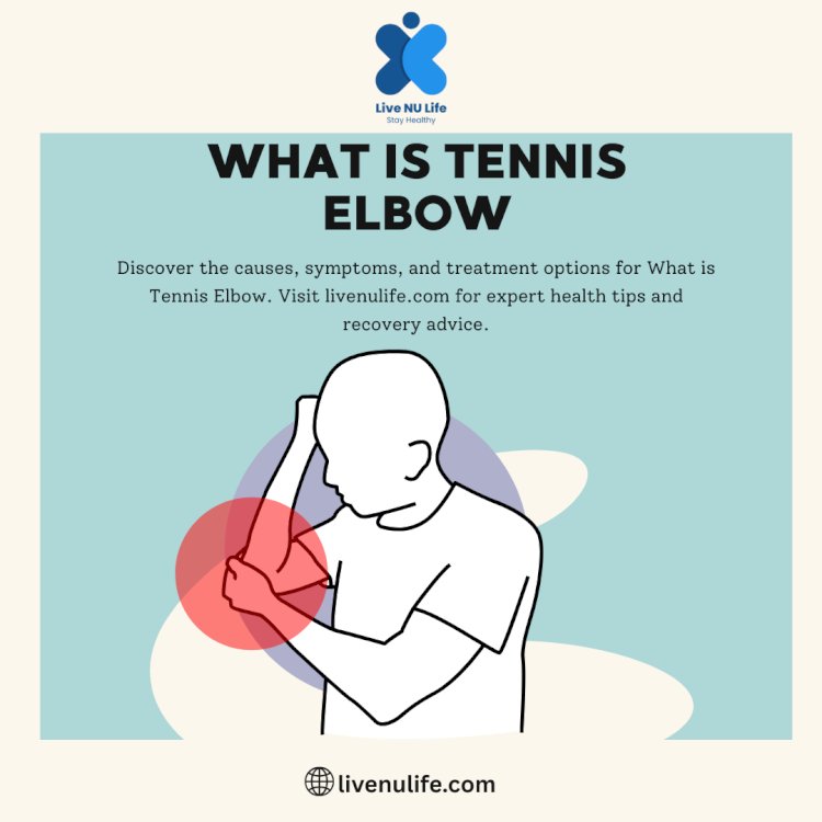 Tennis Elbow: Causes, Symptoms, Diagnosis & Effective Treatments