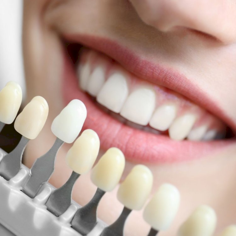 Top 10 Teeth Whitening Ingredients Ranked by Safety & Effectiveness