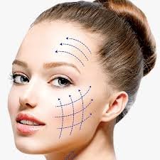 Common Concerns About Thread Lift in Islamabad