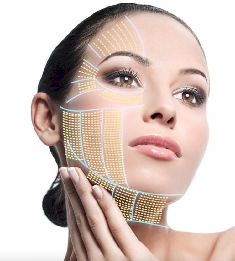 HIFU vs. RF (Radiofrequency): Which is More Effective in Islamabad?