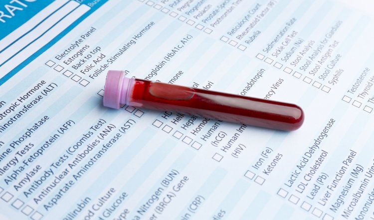 What Makes a Full STD Panel Different From At-Home Tests?