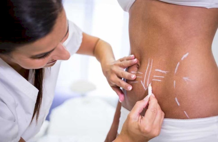Body Contouring in Islamabad: What Locals Are Saying