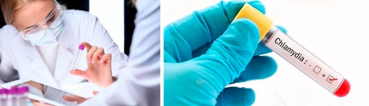 What Doctors Look For in a Chlamydia Test?