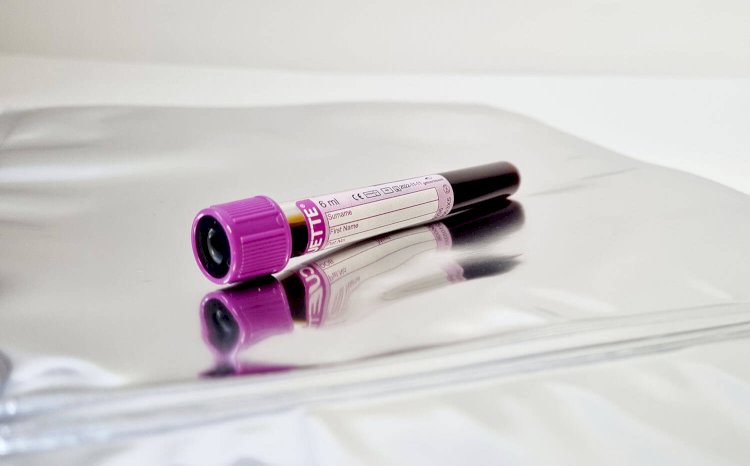DNA Test Reliability Over Time: Does Science Change the Results?