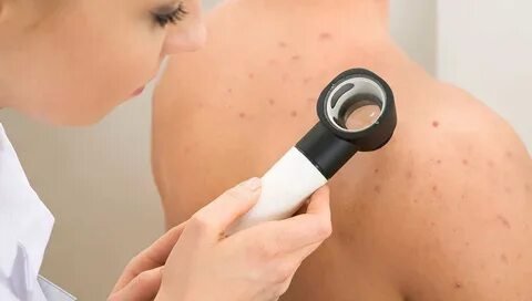 Exploring Preventive Skin Care Strategies at Dermatech Polyclinic