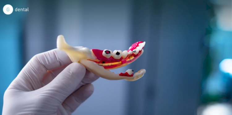 How Lifestyle Habits Affect Your Teeth and Gums