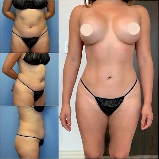 Best Doctors in Dubai for Body Contouring and Body Reshaping Excellence