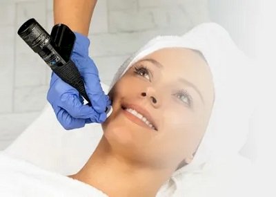 Microchanneling Treatment Benefits for Healthier Skin