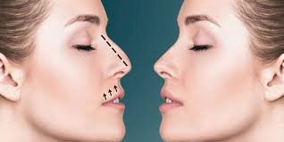 Celebrity-Inspired Rhinoplasty: Natural Looks Without Overdoing It